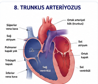 Trunkus arteriyozusta tek ortak arteriyel gövdeyi gösteren şema